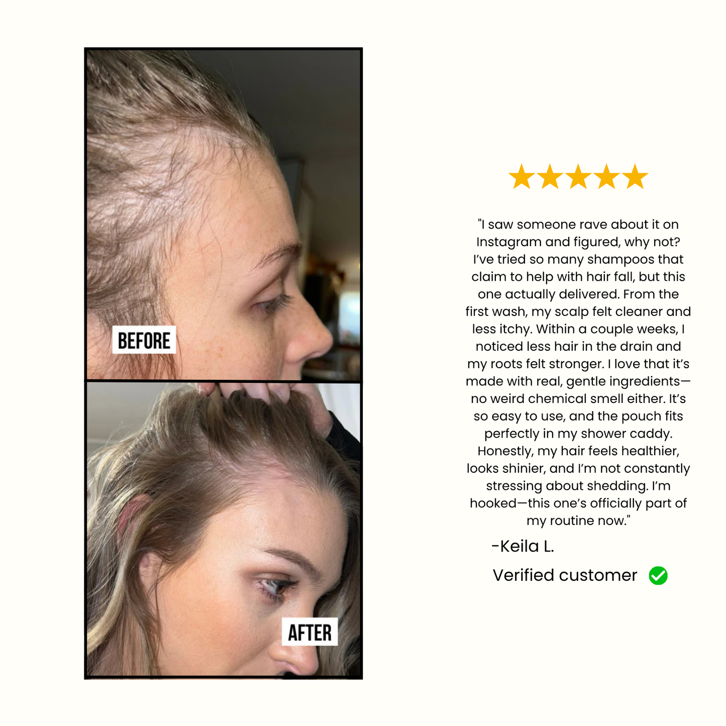 Anti Hair Loss Shampoo