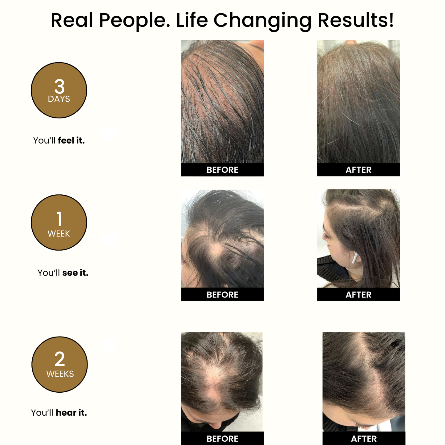 Anti Hair Loss Shampoo